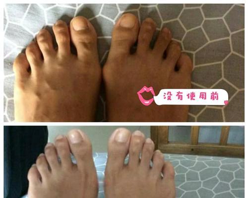 仙人掌发黄软化有什么解决方法？